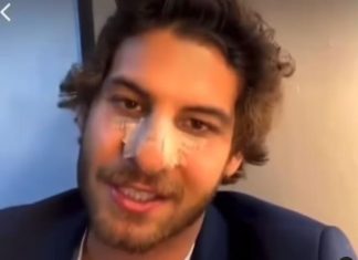 Bir Peri Masalı setinde talihsiz kaza! Dövüş sahnesinde Mustafa Mert Koç’un burnu kırıldı